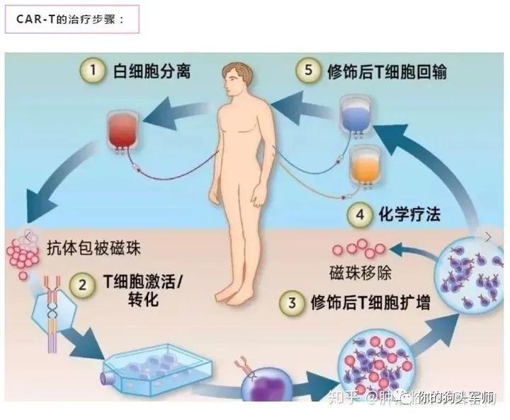 腮腺腫瘤最新治療方法概述